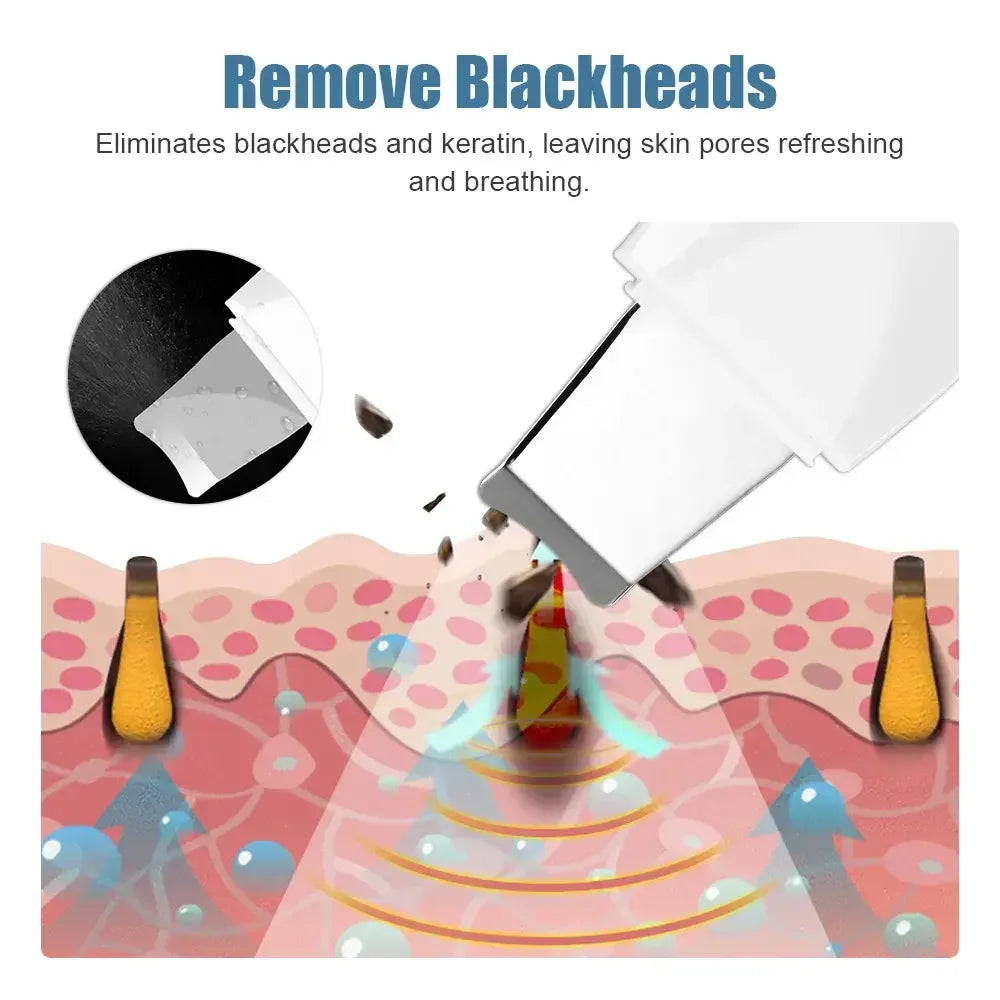 Porepurity Ultrasonic Skin Scrubber